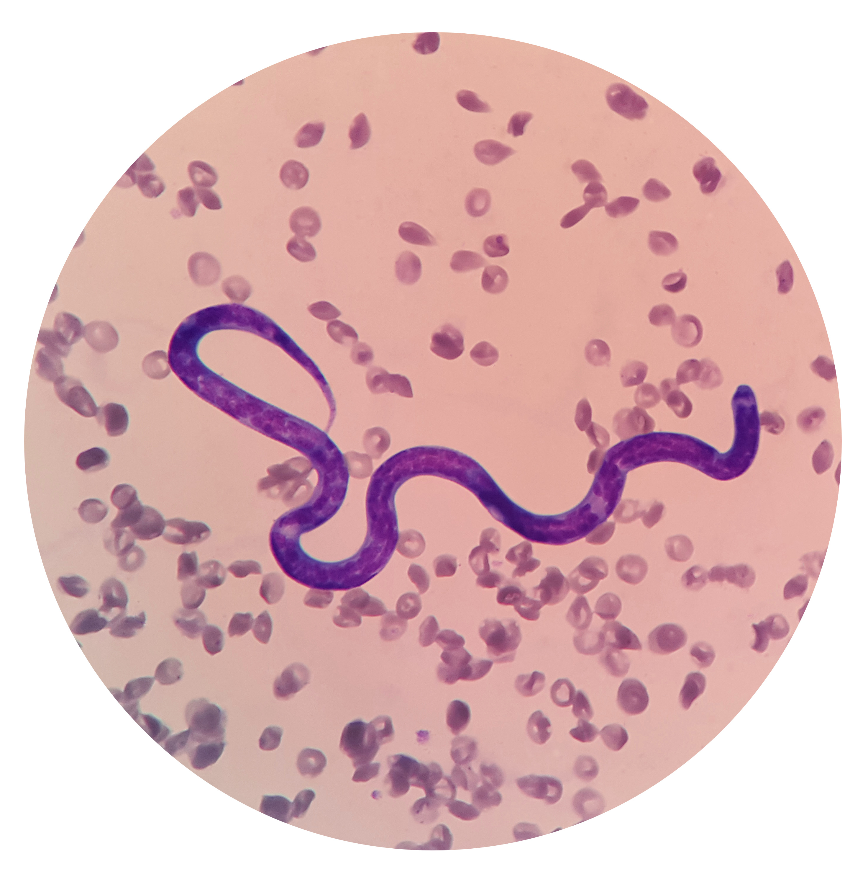 狗狗身上常見寄生蟲：心絲蟲 Heartworm