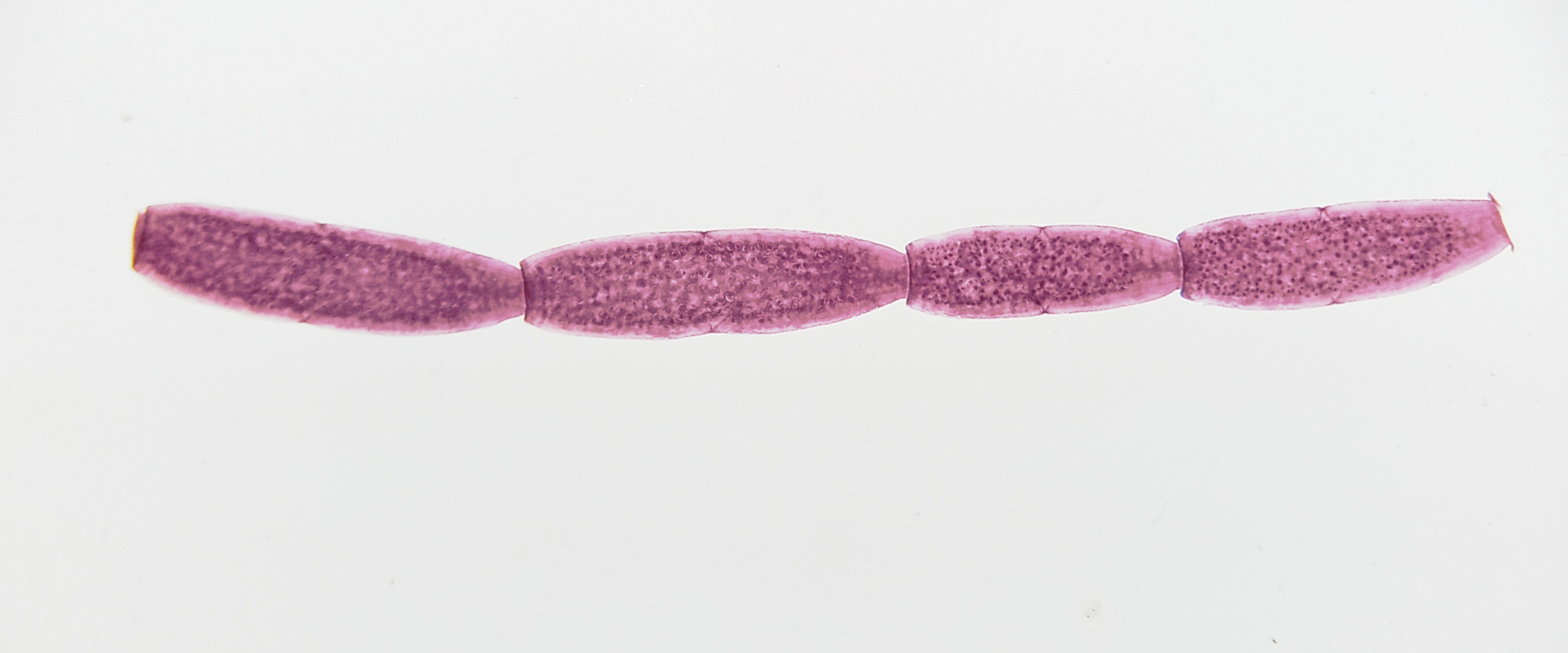 狗狗身上常見寄生蟲:條蟲 Tapeworm Dipylidium caninum